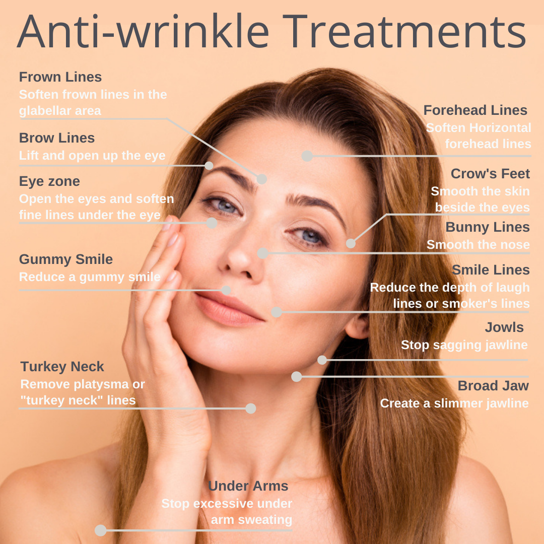 A face map pointing to all the different anti-wrinkle treatments available through Medical Injectables in Wollongong and Orange, NSW